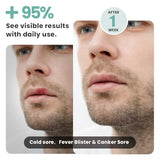 Red Light Therapy for Face, Cold Sore Device Red Light Therapy Wand, FSA-HSA Rechargeable Elite Grade Infrared Light Therapy, Red Light Therapy Cold Sore Device, Ideal for Lips, Skin, Face.