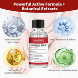 Toenail Fungus Treatment Extra Strength, Nail Fungus Treatment with Undecylenic Acid for Toenail & Fingernails, Antifungal Nail Repair for Athletes Foot, Ingrown, Thick, Broken, Damaged Nail, 30ml