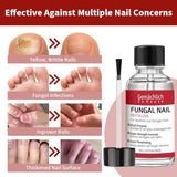 Toenail Fungus Treatment Extra Strength, Nail Fungus Treatment with Undecylenic Acid for Toenail & Fingernails, Antifungal Nail Repair for Athletes Foot, Ingrown, Thick, Broken, Damaged Nail, 30ml