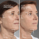 NIRA - FDA Cleared Anti Aging Laser, Red Light Mask Alternative, Large Area