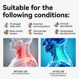 Owlprince Posture Corrector for Neck & Cervical Spine Alignment - Memory Foam Support for Pain Relief, Tech Neck, 360° Adjustable Neck Collar, (White, Large)