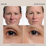 NIRA - FDA Cleared Anti Aging Laser, Red Light Mask Alternative, Large Area