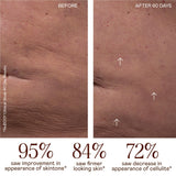 NuFACE NuBODY Toning Device - FDA Cleared Microcurrent Device for All-Over Contouring, Firming & Skin Tightening