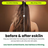 Eskiin Shower Head Water Filter Replacement For The Eskiin Showerhead - High Pressure Shower Heads Replacement For Smooth Hair & Skin - Replacement Cartridge Fits The Eskiin Filtered Shower Head