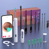 Ear Cleaner with camera Set Ear Sticks Otoscope USB C Charging Endoscope Wax Removal Tool-MD DC PRINT